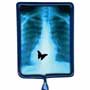 Rectangle-X-Ray thumbnail